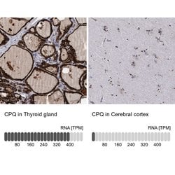 Invitrogen PGCP Polyclonal Antibody 100 &mu;L | Buy Online | Invitrogen&trade; | Fisher Scientific