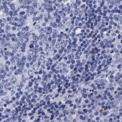 Invitrogen Arylsulfatase G Polyclonal Antibody 100 &mu;L; Unconjugated:Antibodies,