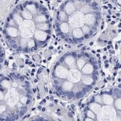 Invitrogen Arylsulfatase G Polyclonal Antibody 100 &mu;L; Unconjugated:Antibodies,