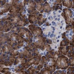 Invitrogen Arylsulfatase G Polyclonal Antibody 100 &mu;L; Unconjugated:Antibodies,