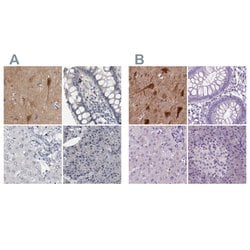 Invitrogen NECAB1 Polyclonal Antibody 100 &mu;L; Unconjugated:Antibodies,