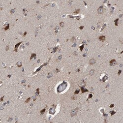 Invitrogen CCDC25 Polyclonal Antibody 100 &mu;L; Unconjugated:Antibodies,