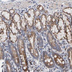 Invitrogen CCDC25 Polyclonal Antibody 100 &mu;L; Unconjugated:Antibodies,