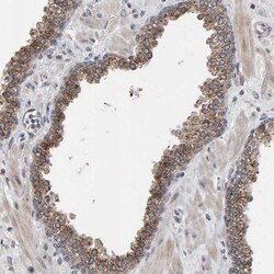 Invitrogen CCDC25 Polyclonal Antibody 100 &mu;L; Unconjugated:Antibodies,