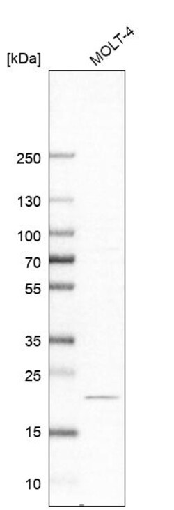 Invitrogen CCDC25 Polyclonal Antibody 100 &mu;L | Buy Online | Invitrogen&trade; | Fisher Scientific