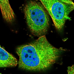 Invitrogen CoA Synthase Polyclonal Antibody 100 &mu;L; Unconjugated:Antibodies,