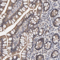 Invitrogen CoA Synthase Polyclonal Antibody 100 &mu;L; Unconjugated:Antibodies,