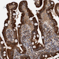 Invitrogen TANC2 Polyclonal Antibody 100 &mu;L; Unconjugated:Anticuerpos