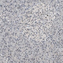 Invitrogen NPLOC4 Polyclonal Antibody 100 &mu;L; Unconjugated:Antibodies,