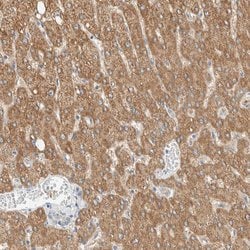 Invitrogen ALDH7A1 Polyclonal Antibody 100 &mu;L; Unconjugated:Antibodies,