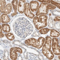 Invitrogen ALDH7A1 Polyclonal Antibody 100 &mu;L; Unconjugated:Antibodies,