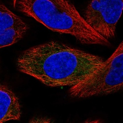 Invitrogen SRP68 Polyclonal Antibody 100 &mu;L | Buy Online | Invitrogen&trade; | Fisher Scientific