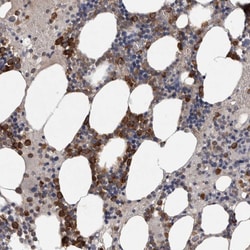 Invitrogen SRP68 Polyclonal Antibody 100 &mu;L | Buy Online | Invitrogen&trade; | Fisher Scientific