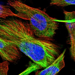 Invitrogen TOM1L2 Polyclonal Antibody 100 &mu;L; Unconjugated:Antibodies,