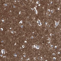 Invitrogen Septin-7 Polyclonal Antibody 100 &mu;L; Unconjugated:Antibodies,