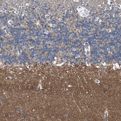 Invitrogen Septin-7 Polyclonal Antibody 100 &mu;L; Unconjugated:Antibodies,