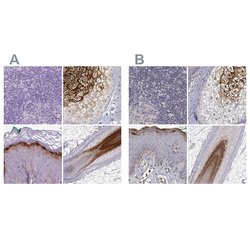 Invitrogen GSDMA Polyclonal Antibody 100 &mu;L; Unconjugated:Antibodies,