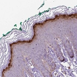 Invitrogen GSDMA Polyclonal Antibody 100 &mu;L; Unconjugated:Antibodies,