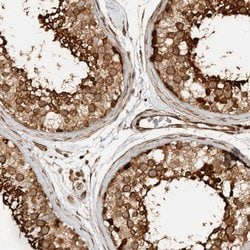 Invitrogen CNTROB Polyclonal Antibody 100 &mu;L; Unconjugated:Antibodies,
