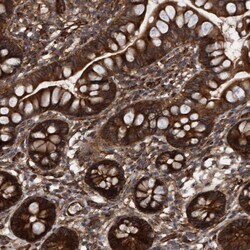 Invitrogen Cdc42EP4 Polyclonal Antibody 100 &mu;L; Unconjugated:Antibodies,