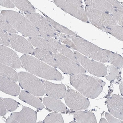 Invitrogen FAM83G Polyclonal Antibody 100 &mu;L | Buy Online | Invitrogen&trade; | Fisher Scientific