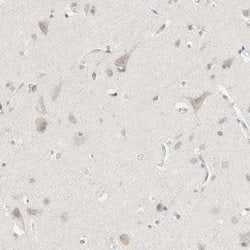 Invitrogen PCM1 Polyclonal Antibody 100 &mu;L; Unconjugated:Antibodies,