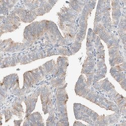 Invitrogen PCM1 Polyclonal Antibody 100 &mu;L; Unconjugated:Antibodies,