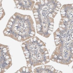 Invitrogen PCM1 Polyclonal Antibody 100 &mu;L; Unconjugated:Antibodies,