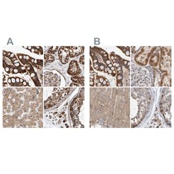 Invitrogen MRPL45 Polyclonal Antibody 100 &mu;L; Unconjugated:Antibodies,