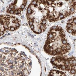 Invitrogen MRPL45 Polyclonal Antibody 100 &mu;L; Unconjugated:Antibodies,