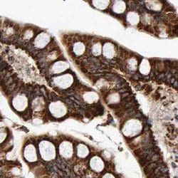 Invitrogen MRPL45 Polyclonal Antibody 100 &mu;L; Unconjugated:Antibodies,