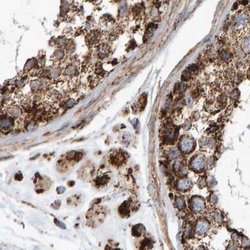 Invitrogen MRPL45 Polyclonal Antibody 100 &mu;L; Unconjugated:Antibodies,