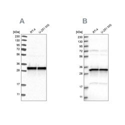 Invitrogen MRPL45 Polyclonal Antibody 100 &mu;L; Unconjugated:Antibodies,