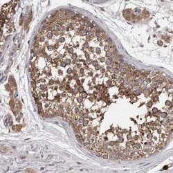 Invitrogen PCM1 Polyclonal Antibody 100 &mu;L; Unconjugated:Antibodies,