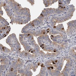Invitrogen PCM1 Polyclonal Antibody 100 &mu;L; Unconjugated:Antibodies,