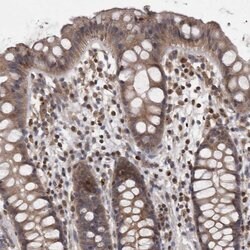 Invitrogen PCM1 Polyclonal Antibody 100 &mu;L; Unconjugated:Antibodies,