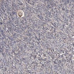 Invitrogen PCM1 Polyclonal Antibody 100 &mu;L; Unconjugated:Antibodies,
