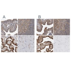 Invitrogen LRRC45 Polyclonal Antibody 100 &mu;L; Unconjugated:Antibodies,