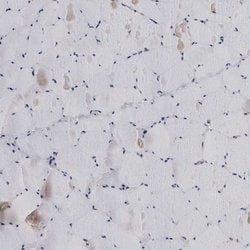 Invitrogen LRRC45 Polyclonal Antibody 100 &mu;L; Unconjugated:Antibodies,