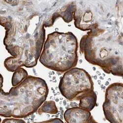 Invitrogen LRRC45 Polyclonal Antibody 100 &mu;L; Unconjugated:Antibodies,