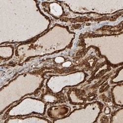 Invitrogen ZFAND1 Polyclonal Antibody 100 &mu;L; Unconjugated:Antibodies,
