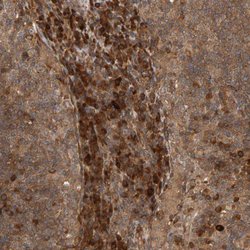 Invitrogen ZFAND1 Polyclonal Antibody 100 &mu;L; Unconjugated:Antibodies,
