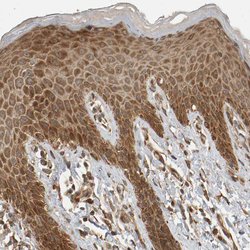Invitrogen ZFAND1 Polyclonal Antibody 100 &mu;L; Unconjugated:Antibodies,