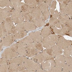 Invitrogen ZFAND1 Polyclonal Antibody 100 &mu;L; Unconjugated:Antibodies,