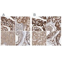 Invitrogen MRPL45 Polyclonal Antibody 100 &mu;L; Unconjugated:Antibodies,