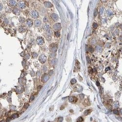 Invitrogen MRPL45 Polyclonal Antibody 100 &mu;L; Unconjugated:Antibodies,