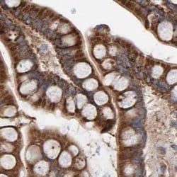 Invitrogen MRPL45 Polyclonal Antibody 100 &mu;L; Unconjugated:Antibodies,