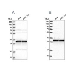 Invitrogen MRPL45 Polyclonal Antibody 100 &mu;L; Unconjugated:Antibodies,
