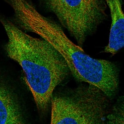 Invitrogen CCDC43 Polyclonal Antibody 100 &mu;L; Unconjugated:Antibodies,