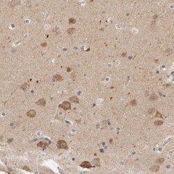 Invitrogen CCDC43 Polyclonal Antibody 100 &mu;L; Unconjugated:Antibodies,